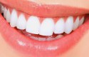 فوائد الشبة للأسنان