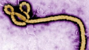 ما هو فيروس الايبولا