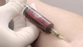 ما هو WBC في تحليل الدم