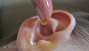 علاج فطريات الأذن