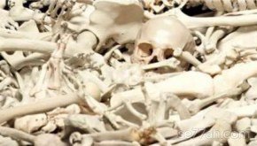 الانسان عدد عظام أنواع العظام