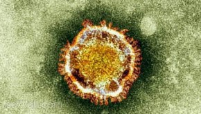 ما أسباب فيروس كورونا