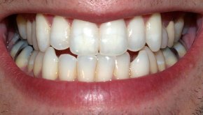 معلومات عامة عن الاسنان