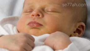 علاج أبو صفار عند حديثي الولادة