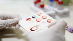 طريقة معرفة فصيلة الدم