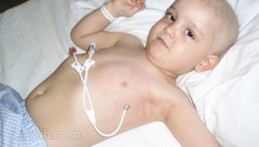 سرطان الدم عند الاطفال