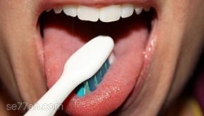 كيفية علاج فطريات الفم