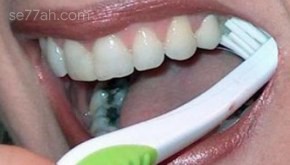 طريقة التخلص من تسوس الأسنان في المنزل