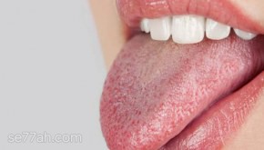 ما أسباب جفاف الفم