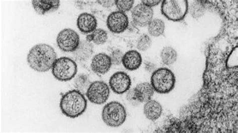 ما هو فيروس  هانتا ؟