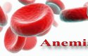 فقر الدم الانيميا