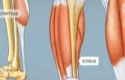 كيف يحدث الشد العضلي