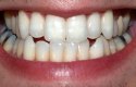 معلومات عامة عن الاسنان