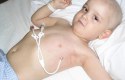 سرطان الدم عند الاطفال
