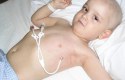أعراض سرطان الدم عند الأطفال
