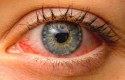 ما هي الأمراض التي تصيب العين