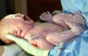 ما هى مخاطر الولادة القيصرية