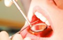 طرق تخفيف ألم الأسنان للحامل