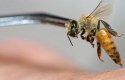 كيفية التداوي بسم النحل