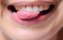 ما علاج الفطريات في الفم