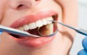 كيف نعالج تسوس الأسنان دون طبيب
