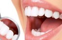 علاج جير الأسنان