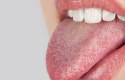 ما أسباب جفاف الفم