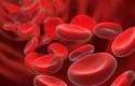 أسباب وعلاج نقص وانخفاض الهيموجلوبين في الدم