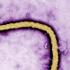 ما هو فيروس الايبولا