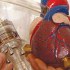 كيف تتم عملية زراعة القلب