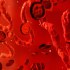 اسباب فقر الدم (الانيميا) و كيفية تشخيصه