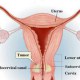 أسباب سرطان عنق الرحم
