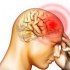 ما هي أعراض جلطة الدماغ