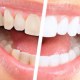 كيفية إزالة الجير من الأسنان