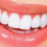 فوائد الشبة للأسنان