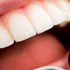 كيفية إزالة التسوس من الأسنان طبيعيا